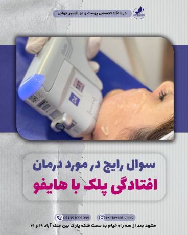درمان افتادگی پلک با هافو در کلینیک تخصصی اکسیرجوانی مشهد